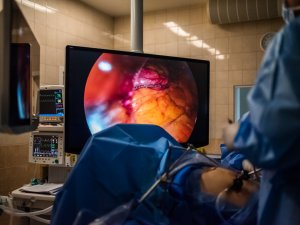 Siguldas slimnīcā pirmoreiz veikta operācija ar jaunāko 4K laparoskopijas iekārtu